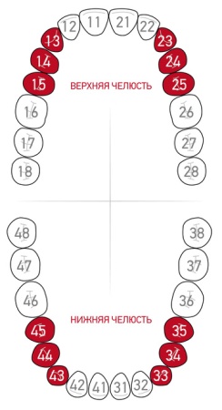 Кламп для коффердама Dentech (Япония) 1АТ